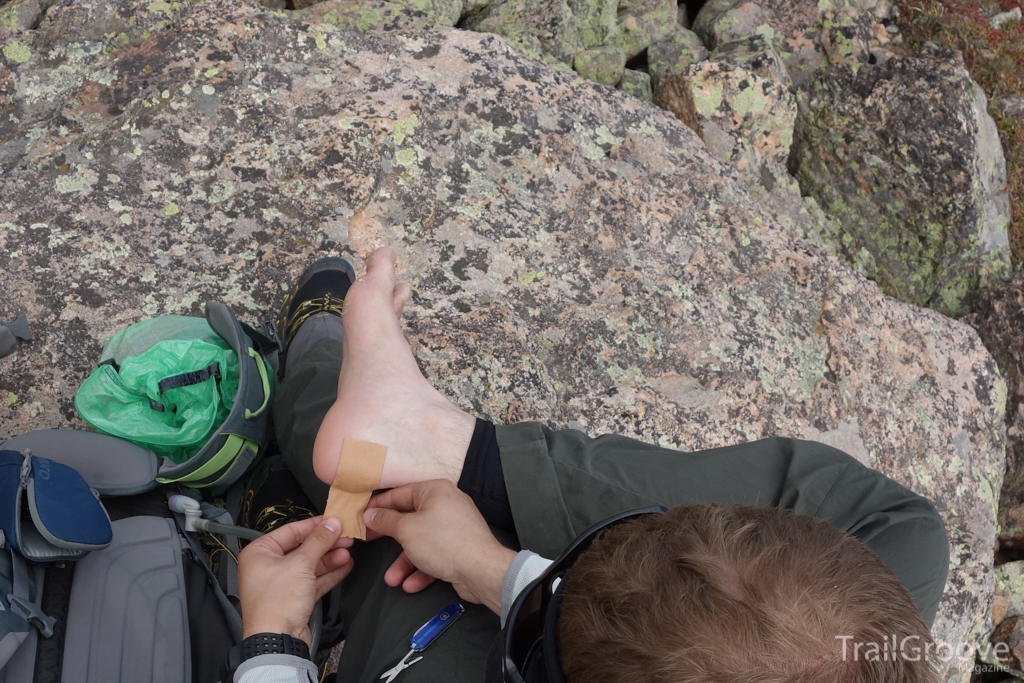 Fixing Blisters and Hotspots while Backpacking and Hiking